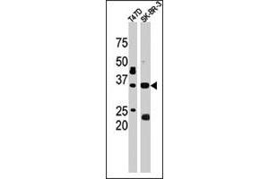The ICMT polyclonal antibody  is used in Western blot to detect ICMT in T-47D (left) and SK-BR-3 (right) cell lysates. (ICMT anticorps  (C-Term))