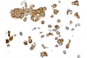 Immunocytochemistry (ICC) image for anti-Glyceraldehyde-3-Phosphate Dehydrogenase (GAPDH) (AA 225-275) antibody (ABIN7449428)