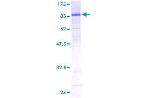 Image no. 1 for Cell Division Cycle 25 Homolog B (S. Pombe) (CDC25B) (AA 43-580) protein (GST tag) (ABIN1348794)