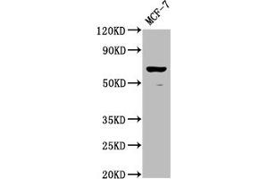Western Blot Positive WB detected in: MCF-7 whole cell lysate All lanes: RPE65 antibody at 1:2000 Secondary Goat polyclonal to rabbit IgG at 1/50000 dilution Predicted band size: 61 kDa Observed band size: 61 kDa (RPE65 anticorps  (AA 348-484))