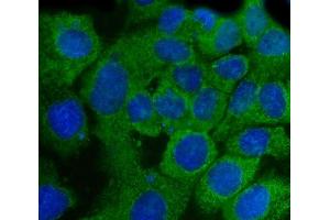 IF analysis of SSH3BP1/ABI1 using anti-SSH3BP1/ABI1 antibody (ABIN3043515).