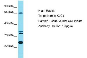 Host: Rabbit Target Name: KLC4 Sample Tissue: Human Jurkat Whole Cell Antibody Dilution: 1ug/ml (KLC4 anticorps  (N-Term))