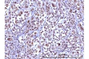 IHC analysis of RNF40 using anti-RNF40 antibody (ABIN7602723).