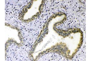 IHC analysis of TNFSF18 using anti-TNFSF18 antibody .