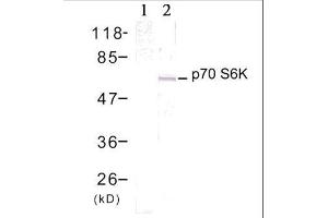Western blot analysis of extract from 293 cells treated with EGF (200ng/ml, 15min), using p70 S6 Kinase (Ab-389) antibody (E021182, Lane 1 and 2). (RPS6KB1 anticorps)