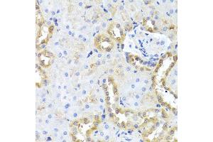 Immunohistochemistry of paraffin-embedded rat kidney using CGB7 antibody (ABIN5974696) at dilution of 1/100 (40x lens). (CGB7 anticorps)