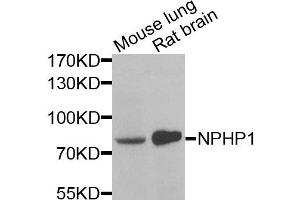 Western blot analysis of extracts of various cells, using NPHP1 antibody. (NPHP1 anticorps)