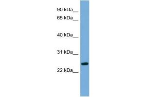 WB Suggested Anti-C6orf94 Antibody Titration:  0. (FAM164B anticorps  (N-Term))