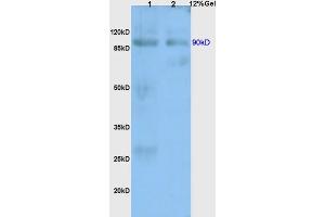 Mouse heart lysates probed with Anti TLR4/CD284 Polyclonal Antibody, Unconjugated (ABIN736491) at 1:200 overnight at 4 °C.