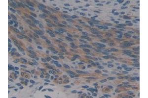 Detection of MRP1 in Mouse Uterus Tissue using Polyclonal Antibody to Multidrug Resistance Associated Protein 1 (MRP1)