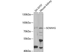 Western blot analysis of extracts of various cell lines, using SCNN1G antibody (ABIN6129468, ABIN6147453, ABIN6147454 and ABIN6221724) at 1:1000 dilution.