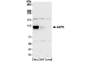 Western Blotting (WB) image for anti-Aspartate beta-Hydroxylase (ASPH) (AA 708-758) antibody (ABIN7453038)