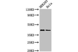 Western Blot Positive WB detected in: HEK293 whole cell lysate, Hela whole cell lysate All lanes: GALK1 antibody at 3 μg/mL Secondary Goat polyclonal to rabbit IgG at 1/50000 dilution Predicted band size: 43, 46 kDa Observed band size: 43 kDa (GALK1 anticorps  (AA 23-164))