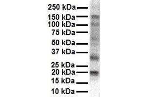 WB Suggested Anti-KCNAB2 antibody Titration: 1 ug/mL Sample Type: Human HepG2 (KCNAB2 anticorps  (Middle Region))