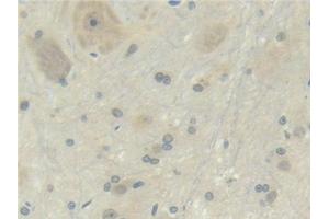 Detection of RANkL in Rat Bone marrow Tissue using Polyclonal Antibody to Receptor Activator Of Nuclear Factor Kappa B Ligand (RANkL)