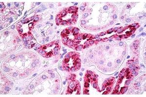 Anti-REN / Renin antibody IHC staining of human kidney, tubules. (Renin anticorps)