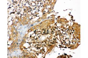Anti-CIAS1/NALP3 antibody, IHC(P) IHC(P): Human Tonsil Tissue (NLRP3 anticorps  (N-Term))