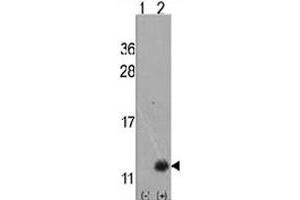 Western blot analysis of URM1 polyclonal antibody . (Urm1 anticorps  (N-Term))