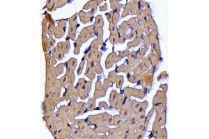 IHC analysis of ATP5F1B using anti-ATP5F1B antibody (ABIN7599866). (Atp5f1b (AA 123-529) anticorps)
