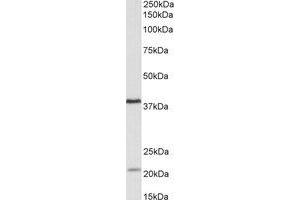 Western Blotting (WB) image for anti-Kelch Domain Containing 8B (KLHDC8B) (Internal Region) antibody (ABIN2464990) (KLHDC8B anticorps  (Internal Region))