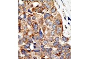 Image no. 2 for anti-Protein Inhibitor of Activated STAT, 4 (PIAS4) (C-Term) antibody (ABIN356771) (PIAS4 anticorps  (C-Term))