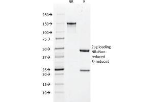 SDS-PAGE Analysis Purified Cytokeratin 18 Mouse Monoclonal Antibody (DC10). (Cytokeratin 18 anticorps)