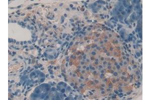 DAB staining on IHC-P; Samples: Rat Pancreas Tissue (IGF2R anticorps  (AA 1146-1363))