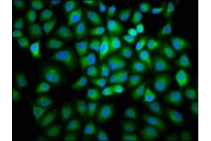 Immunofluorescence staining of Hela cells with ABIN7153405 at 1:166, counter-stained with DAPI.