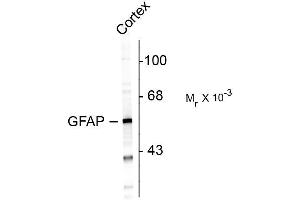 Western blots of rat cortex lysate showing specific immunolabeling of the ~ 50k GFAP protein. (GFAP anticorps)