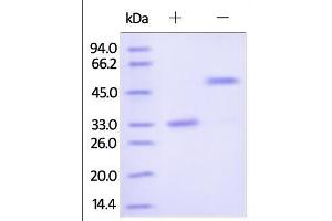 Human IgG2 Fc, Tag Free on SDS-PAGE under reducing (R) and no-reducing (NR) conditions. (HEK-293 Cells IgG2 Isotype Control)