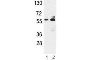 Western blot analysis of G6PD antibody and 1) K562, 2) MCF-7 lysate. (Glucose-6-Phosphate Dehydrogenase anticorps  (AA 297-326))