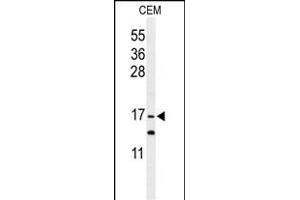 Western blot analysis of GMFG Antibody (C-term) (ABIN652407 and ABIN2841991) in CEM cell line lysates (35 μg/lane). (GMFG anticorps  (C-Term))
