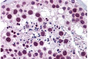 anti-Tripartite Motif Containing 22 (TRIM22) (AA 74-123) antibody