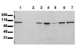 Western Blotting (WB) image for anti-Signal Transducer and Activator of Transcription 6, Interleukin-4 Induced (STAT6) antibody (ABIN126902) (STAT6 anticorps)