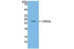 Detection of Recombinant IGFBP2, Human using Polyclonal Antibody to Insulin Like Growth Factor Binding Protein 2 (IGFBP2)
