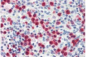 Human Spleen, Granulocytes (formalin-fixed, paraffin-embedded) stained with S100A8 antibody ABIN334255 at 1:50 followed by biotinylated anti-mouse IgG secondary antibody ABIN481714, alkaline phosphatase-streptavidin and chromogen.