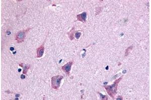 Immunohistochemical staining of human brain, neurons and glia with QRFPR polyclonal antibody . (QRFPR anticorps  (N-Term))