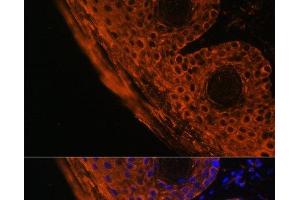 Immunofluorescence analysis of Mouse skin cells using TGM1 Polyclonal Antibody at dilution of 1:100. (TGM1 anticorps)