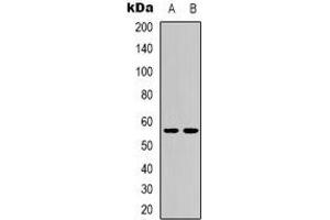 Western blot analysis of CD276 expression in MCF7 (A), HEK293T (B) whole cell lysates. (CD276 anticorps)