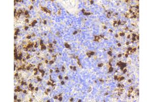 Immunohistochemistry of paraffin-embedded human spleen using LYZ antibody (ABIN5997039) at dilution of 1/100 (40x lens). (LYZ anticorps)