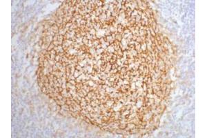 Immunohistochemistry (IHC) image for anti-Complement Component (3d/Epstein Barr Virus) Receptor 2 (CR2) antibody (ABIN3181130) (CD21 anticorps)