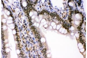 IHC analysis of p95 NBS1 using anti-p95 NBS1 antibody (ABIN3043282). (Nibrin anticorps  (C-Term))