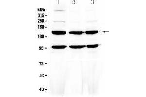 Western blot analysis of VEGF Receptor 3 using anti-VEGF Receptor 3 antibody .