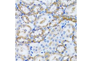 Immunohistochemistry of paraffin-embedded mouse kidney using PEX5 antibody (ABIN6133015, ABIN6145469, ABIN6145471 and ABIN6221464) at dilution of 1:100 (40x lens). (PEX5 anticorps  (AA 1-260))