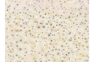 ABIN6259284 and ABIN6273374 at 1/100 staining human normal liver tissue by IHC-P. (PSPC1 anticorps  (C-Term))