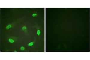Immunofluorescence analysis of HeLa cells, using p53 (Acetyl-Lys379) Antibody. (p53 anticorps  (acLys381))