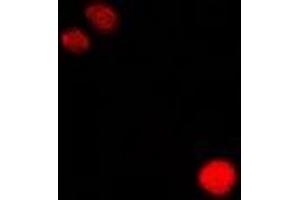Immunofluorescent analysis of CLIC1 staining in Hela cells.