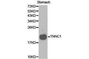 Western Blotting (WB) image for anti-Cardiac Troponin C (TNNC1) antibody (ABIN1875147) (TNNC1 anticorps)