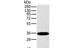 Western Blot analysis of Mouse brain tissue using PPP2CA Polyclonal Antibody at dilution of 1:450 (PPP2CA anticorps)