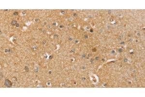Immunohistochemistry of paraffin-embedded Human brain tissue using SLC41A2 Polyclonal Antibody at dilution 1:45 (SLC41A2 anticorps)
